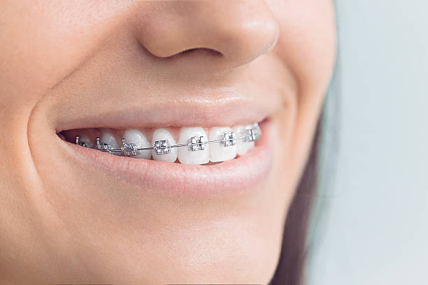 Why Choose Us for Your Dental Needs in Pollock Pines, CA